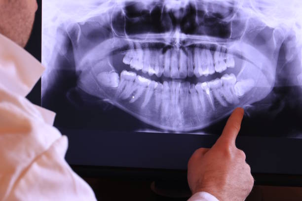 Best Emergency Broken Tooth Repair in Windsor, NC
