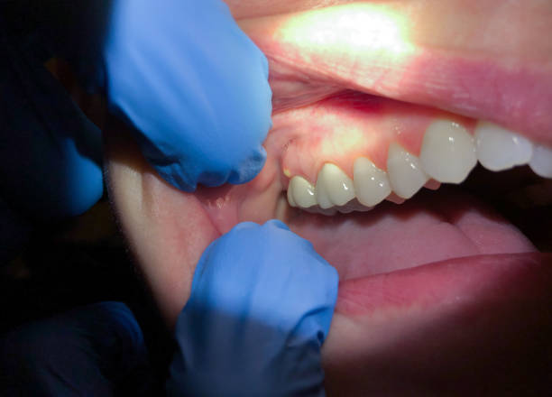 Best Emergency Treatment for Toothache in Windsor, NC