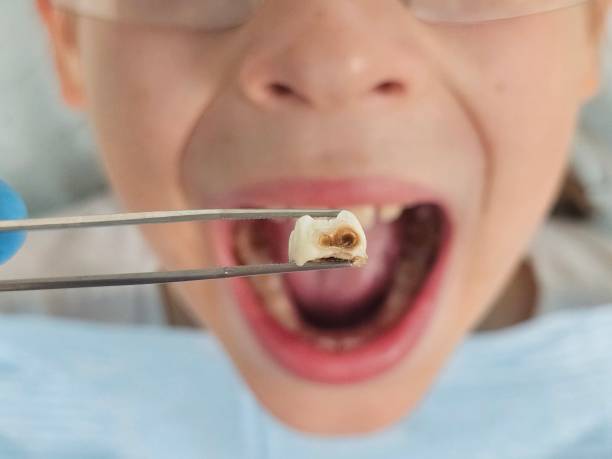 Best Emergency Treatment for Toothache in Windsor, NC